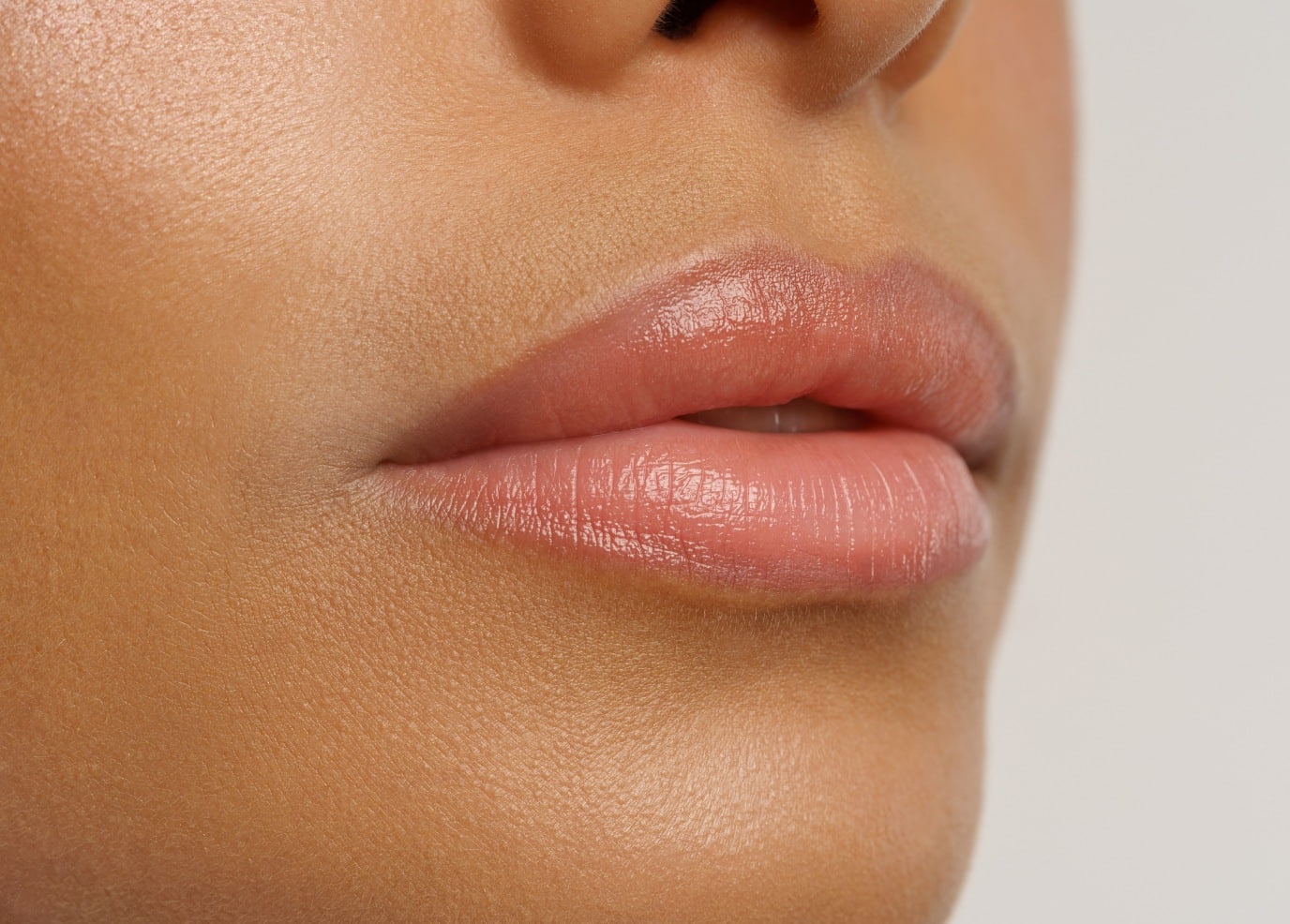 Injection des lèvres à Montpellier | Acide hyaluronique bouche | Médecine esthétique | Clinique beauté