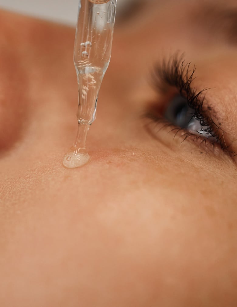 Goute sur la joue d une femme epicutis soins cosmetique peau sensible - Hind clinique de beaute Montpellier